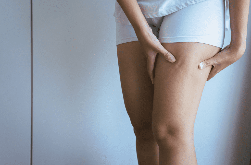 Celulitis: masaje para reducirla en las piernas - Buena Vida Tips