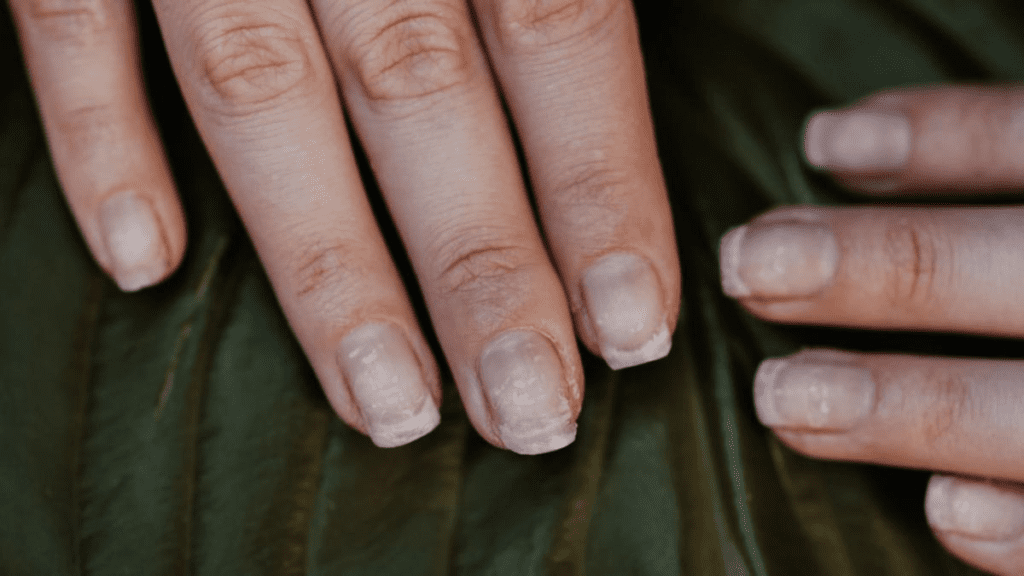 Fortalecedores de uñas en casa para que no se rompan o debiliten - Buena Vida Tips