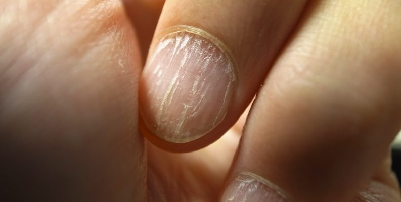 Fortalecedores de uñas en casa para que no se rompan o debiliten - Buena Vida Tips